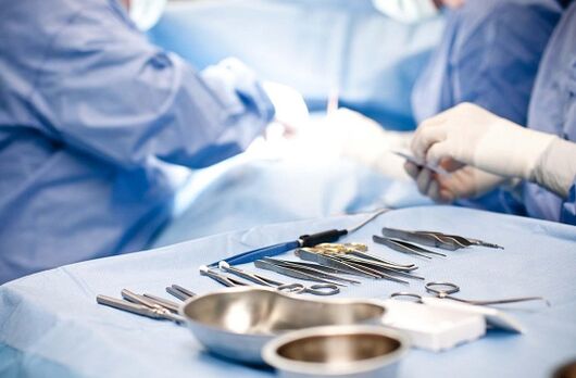Ang interbensyon sa kirurhiko sa talamak na prostatitis